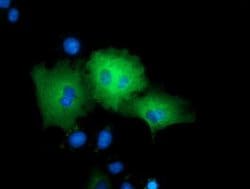 ARHGAP25 Monoclonal Antibody (OTI4D8), TrueMAB , OriGene:Antibodies:Primary