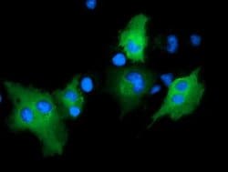 ARHGAP25 Monoclonal Antibody (OTI11B9), TrueMAB , OriGene 30 &mu;L; Unconjugated:Antibodies,