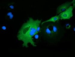ARHGAP25 Monoclonal Antibody (OTI11D3), TrueMAB , OriGene:Antibodies:Primary
