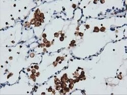 ARHGAP25 Mouse anti-Human, Clone: OTI12E6, lyophilized, TrueMAB 100 &mu;g;