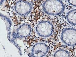 ARHGAP25 Monoclonal Antibody (OTI12E6), TrueMAB , OriGene 30 &mu;L; Unconjugated:Antibodies,