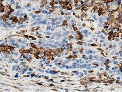 ARHGAP25 Mouse anti-Human, Clone: OTI12G4, lyophilized, TrueMAB 100 &mu;g;