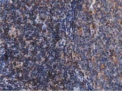 ARHGAP25 Mouse anti-Human, Clone: OTI3G1, lyophilized, TrueMAB 100 &mu;g;