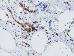 ARHGAP25 Monoclonal Antibody (OTI11B9), TrueMAB , OriGene 30 &mu;L; Unconjugated:Antibodies,