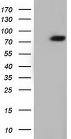 ARHGAP25 Monoclonal Antibody (OTI2D6), TrueMAB , OriGene 30 &mu;L | Buy Online | Origene Technologies | Fisher Scientific