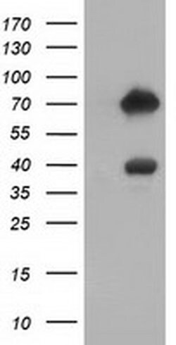 ARHGAP25 Monoclonal Antibody (OTI2D5), TrueMAB , OriGene 100 &mu;L; Unconjugated:Antibodies,