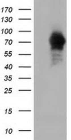 ARHGAP25 Mouse anti-Human, Clone: OTI12E6, lyophilized, TrueMAB 100 &mu;g;