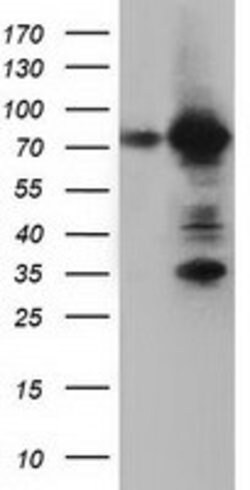 ARHGAP25 Mouse anti-Human, Clone: OTI12G4, lyophilized, TrueMAB 100 &mu;g;