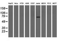 ARHGAP25 Mouse anti-Human, Clone: OTI12G4, lyophilized, TrueMAB 100 &mu;g;