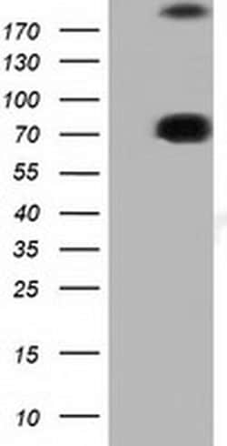 ARHGAP25 Monoclonal Antibody (OTI4D8), TrueMAB , OriGene 100 &mu;L; Unconjugated:Antibodies,
