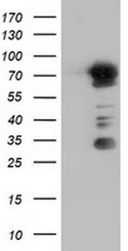 ARHGAP25 Monoclonal Antibody (OTI11D3), TrueMAB , OriGene 100 &mu;L; Unconjugated:Antibodies,