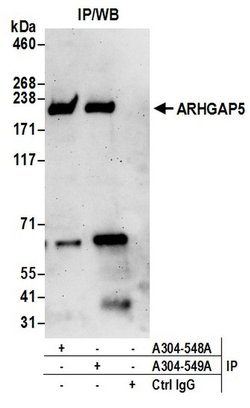 ARHGAP5 Rabbit anti-Human, Mouse, Polyclonal, Bethyl Laboratories 100 &mu;l;
