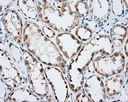 ARHGDIA Monoclonal Antibody (OTI1A7), TrueMAB , OriGene 30 &mu;L | Buy Online | OriGene | Fisher Scientific