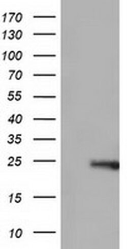 ARHGDIA Monoclonal Antibody (OTI1F2), TrueMAB , OriGene 30 &mu;L; Unconjugated:Antibodies,