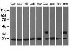 ARHGDIA Monoclonal Antibody (OTI1F2), TrueMAB , OriGene 30 &mu;L; Unconjugated:Antibodies,