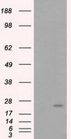 ARHGDIA Monoclonal Antibody (OTI1A7), TrueMAB , OriGene 30 &mu;L | Buy Online | OriGene | Fisher Scientific