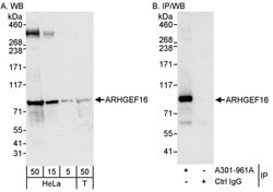 ARHGEF16 Rabbit anti-Human, Polyclonal, Bethyl Laboratories 100 &mu;L;