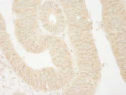 ARHGEF16 Polyclonal Antibody, Bethyl Laboratories 100 &mu;L; Unconjugated:Antibodies,