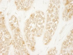 ARHGEF16 Polyclonal Antibody, Bethyl Laboratories 100 &mu;L; Unconjugated:Antibodies,
