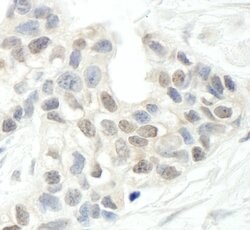 ARID2 Rabbit anti-Human, Polyclonal, Bethyl Laboratories 100 &mu;L; Unconjugated:Antibodies,
