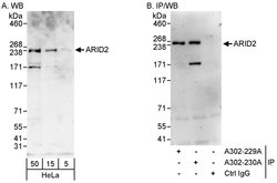 ARID2 Rabbit anti-Human, Polyclonal, Bethyl Laboratories 100 &mu;L; Unconjugated:Antibodies,