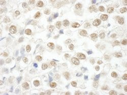 ARID2 Polyclonal Antibody, Bethyl Laboratories:Antibodies:Primary Antibodies