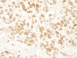 ARID4B Rabbit anti-Human, Polyclonal, Bethyl Laboratories 100 &mu;l; Unlabeled:Antibodies,