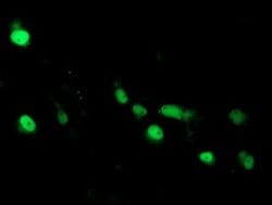 ARL2BP Mouse anti-Human, Clone: OTI1A10, lyophilized, TrueMAB 100 &mu;g;