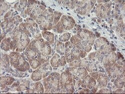 ARL2BP Mouse anti-Human, Clone: OTI1A10, lyophilized, TrueMAB 100 &mu;g;