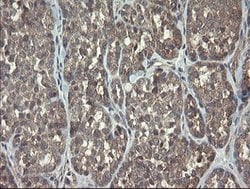 ARL2BP Mouse anti-Human, Clone: OTI1A10, lyophilized, TrueMAB 100 &mu;g;