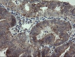 ARL2BP Mouse anti-Human, Clone: OTI1A10, lyophilized, TrueMAB 100 &mu;g;