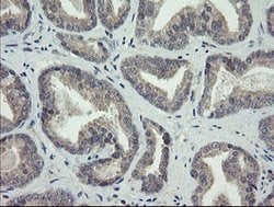 ARL2BP Mouse anti-Human, Clone: OTI1A10, lyophilized, TrueMAB 100 &mu;g;
