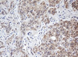 ARL2BP Mouse anti-Human, Clone: OTI4C4, lyophilized, TrueMAB 100 &mu;g;