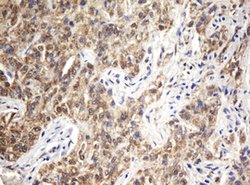 ARL2BP Mouse anti-Human, Clone: OTI1E5, lyophilized, TrueMAB 100 &mu;g;