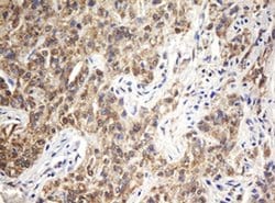 ARL2BP Monoclonal Antibody (OTI1E5), TrueMAB , OriGene 100 &mu;L; Unconjugated:Antibodies,