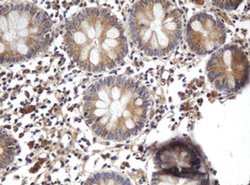 ARL2BP Monoclonal Antibody (OTI1F8), TrueMAB , OriGene 100 &mu;L; Unconjugated:Antibodies,