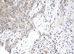 ARL2BP Monoclonal Antibody (OTI1F8), TrueMAB , OriGene 100 &mu;L; Unconjugated:Antibodies,