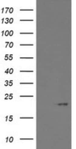 ARL2BP Mouse anti-Human, Clone: OTI1A10, lyophilized, TrueMAB 100 &mu;g;