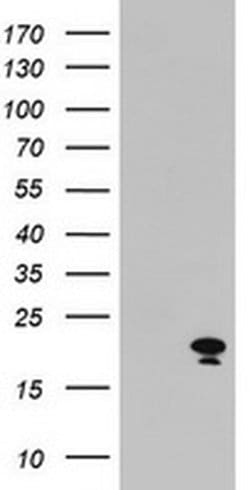 ARL2BP Monoclonal Antibody (OTI1F8), TrueMAB , OriGene 100 &mu;L; Unconjugated:Antibodies,