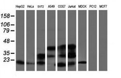 ARL2BP Monoclonal Antibody (OTI1F8), TrueMAB , OriGene 100 &mu;L; Unconjugated:Antibodies,