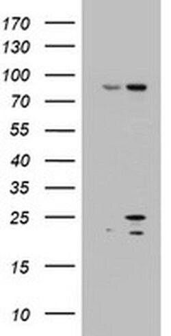 ARL3 Monoclonal Antibody (OTI3C6), TrueMAB , OriGene:Antibodies:Primary