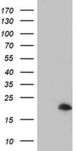 ARL5B Monoclonal Antibody (OTI2D7), TrueMAB , OriGene:Antibodies:Primary