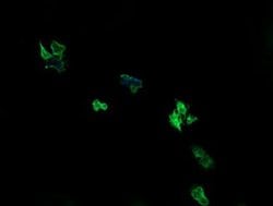 ARMC1 Monoclonal Antibody (OTI1D10), TrueMAB , OriGene 30 &mu;L; Unconjugated:Antibodies,
