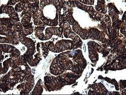 ARMC1 Monoclonal Antibody (OTI1D10), TrueMAB , OriGene 30 &mu;L; Unconjugated:Antibodies,