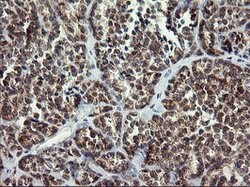 ARMC1 Mouse anti-Human, Clone: OTI2G8, lyophilized, TrueMAB 100 &mu;g;