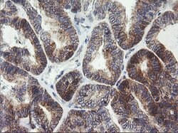 ARMC1 Mouse anti-Human, Clone: OTI2G8, lyophilized, TrueMAB 100 &mu;g;