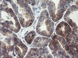 ARMC1 Monoclonal Antibody (OTI2G8), TrueMAB , OriGene 100 &mu;L; Unconjugated:Antibodies,