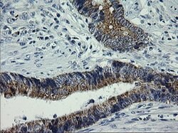 ARMC1 Monoclonal Antibody (OTI2G8), TrueMAB , OriGene 100 &mu;L; Unconjugated:Antibodies,