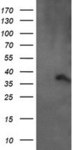 ARMC1 Mouse anti-Human, Clone: OTI2G8, lyophilized, TrueMAB 100 &mu;g;