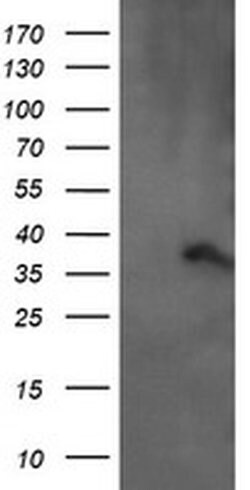 ARMC1 Monoclonal Antibody (OTI2G8), TrueMAB , OriGene 100 &mu;L; Unconjugated:Antibodies,